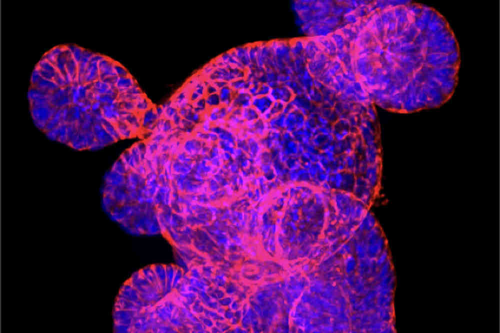 Source: University of Toronto